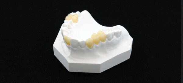 Graphy Crown & Bridge Resin (TC-80DP) - Image 2