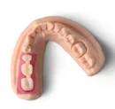 Graphy Gingiva Mask (TE-600R)